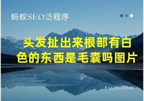 头发扯出来根部有白色的东西是毛囊吗图片