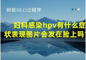 妇科感染hpv有什么症状表现图片会发在脸上吗?