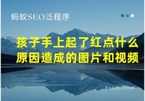 孩子手上起了红点什么原因造成的图片和视频