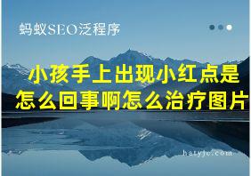 小孩手上出现小红点是怎么回事啊怎么治疗图片