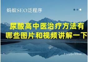 尿酸高中医治疗方法有哪些图片和视频讲解一下