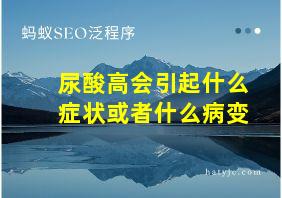 尿酸高会引起什么症状或者什么病变