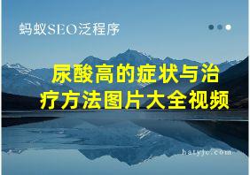 尿酸高的症状与治疗方法图片大全视频