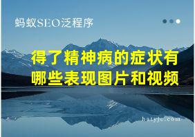 得了精神病的症状有哪些表现图片和视频