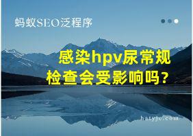 感染hpv尿常规检查会受影响吗?