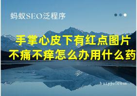 手掌心皮下有红点图片不痛不痒怎么办用什么药