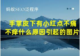 手掌皮下有小红点不痛不痒什么原因引起的图片