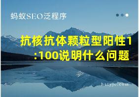 抗核抗体颗粒型阳性1:100说明什么问题