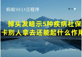 掉头发暗示5种疾病社保卡别人拿去还能起什么作用