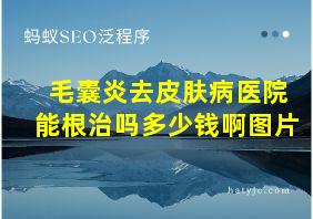 毛囊炎去皮肤病医院能根治吗多少钱啊图片