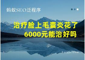 治疗脸上毛囊炎花了6000元能治好吗