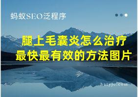 腿上毛囊炎怎么治疗最快最有效的方法图片