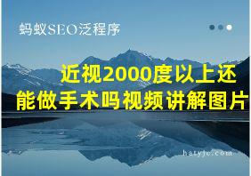 近视2000度以上还能做手术吗视频讲解图片