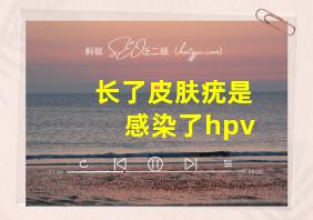 长了皮肤疣是感染了hpv