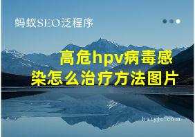 高危hpv病毒感染怎么治疗方法图片