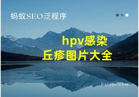 hpv感染丘疹图片大全