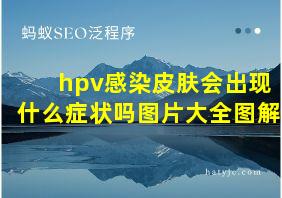 hpv感染皮肤会出现什么症状吗图片大全图解