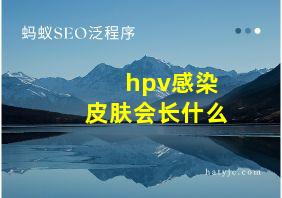 hpv感染皮肤会长什么