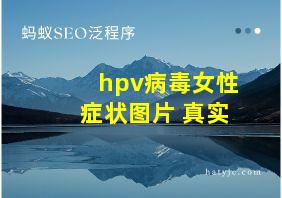 hpv病毒女性症状图片 真实