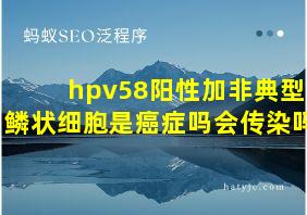 hpv58阳性加非典型鳞状细胞是癌症吗会传染吗